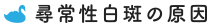 尋常性白斑の原因